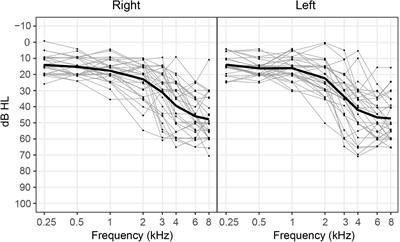 Age-Related Deficits in Electrophysiological and Behavioral Measures of Binaural Temporal Processing